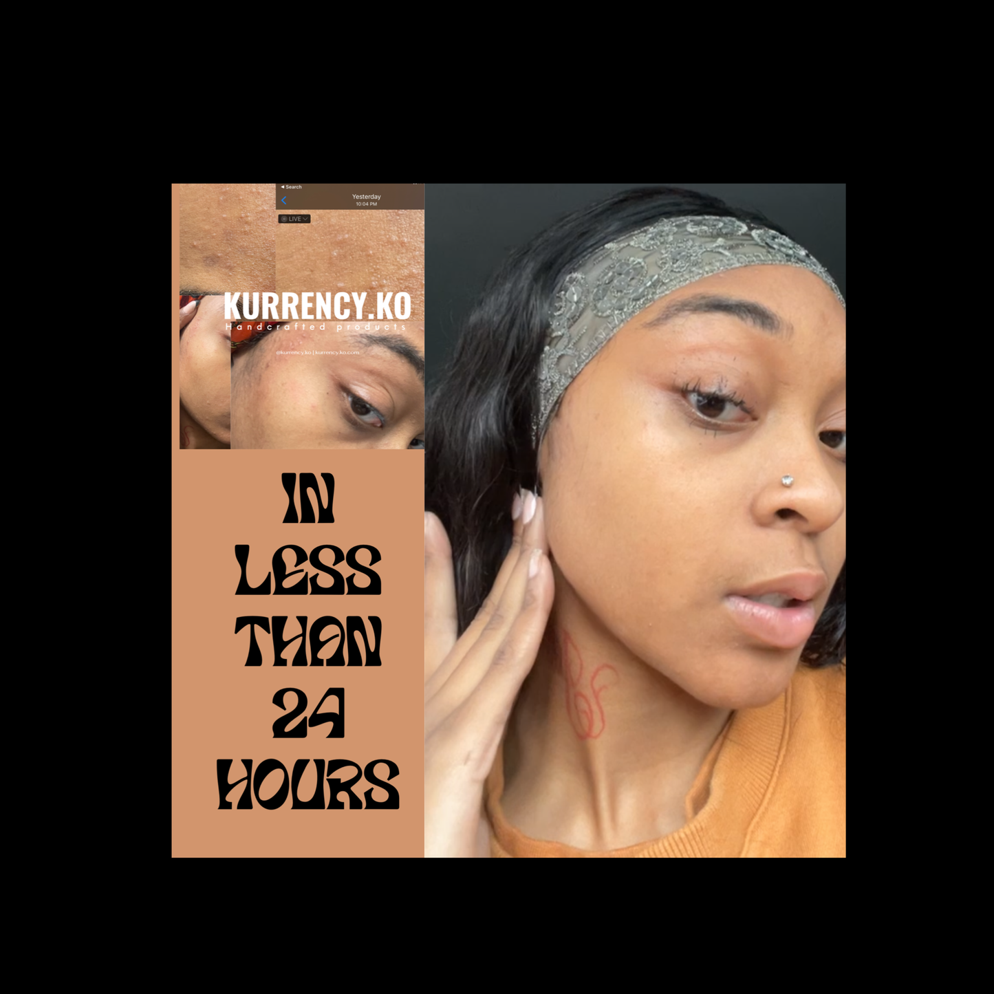 1Turmeric + Honey Face Bar